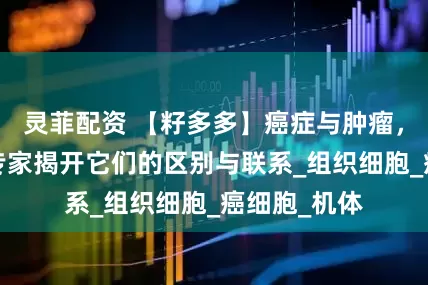 灵菲配资 【籽多多】癌症与肿瘤，俄罗斯MC专家揭开它们的区别与联系_组织细胞_癌细胞_机体